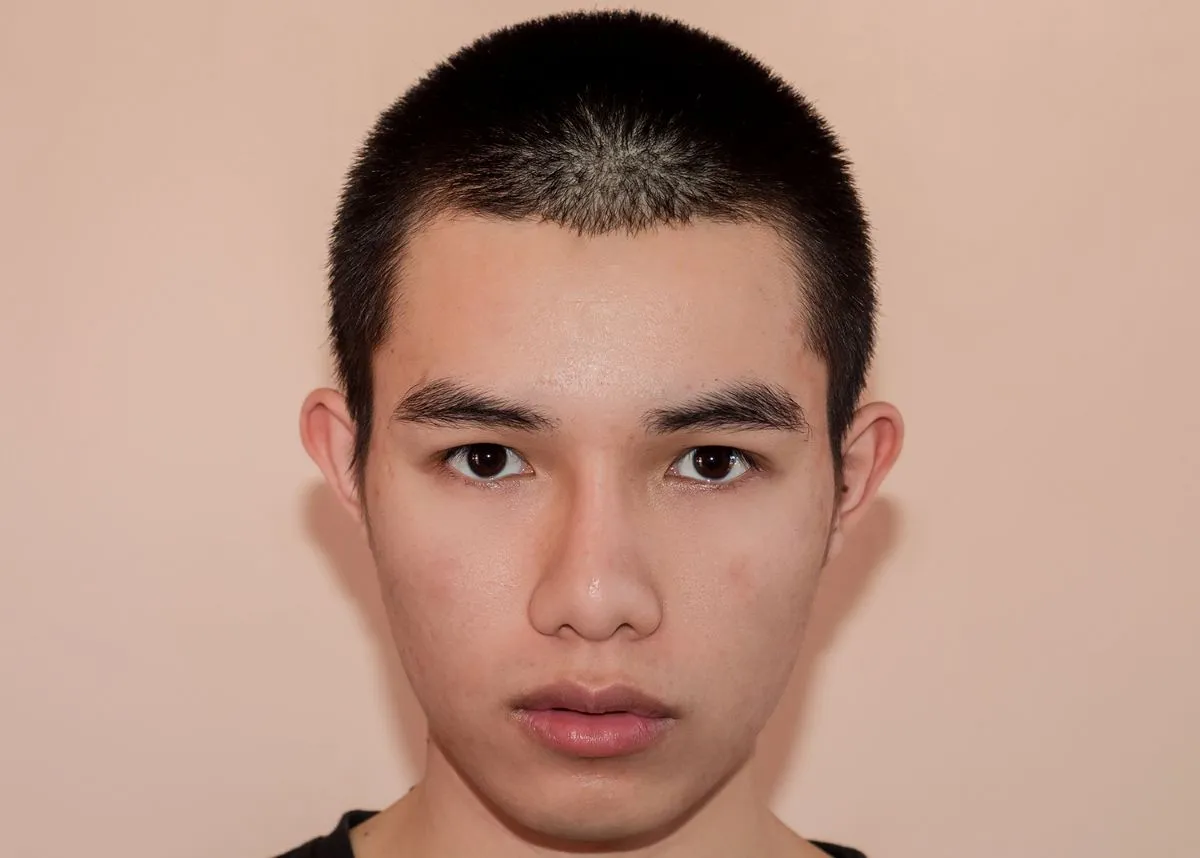 Man face after removing pimples